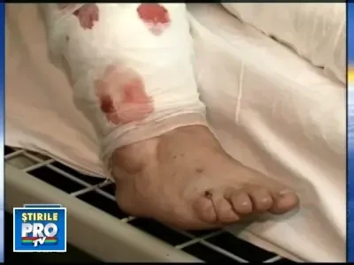 Doua batrane din Timisoara, sfasiate de o haita de caini!