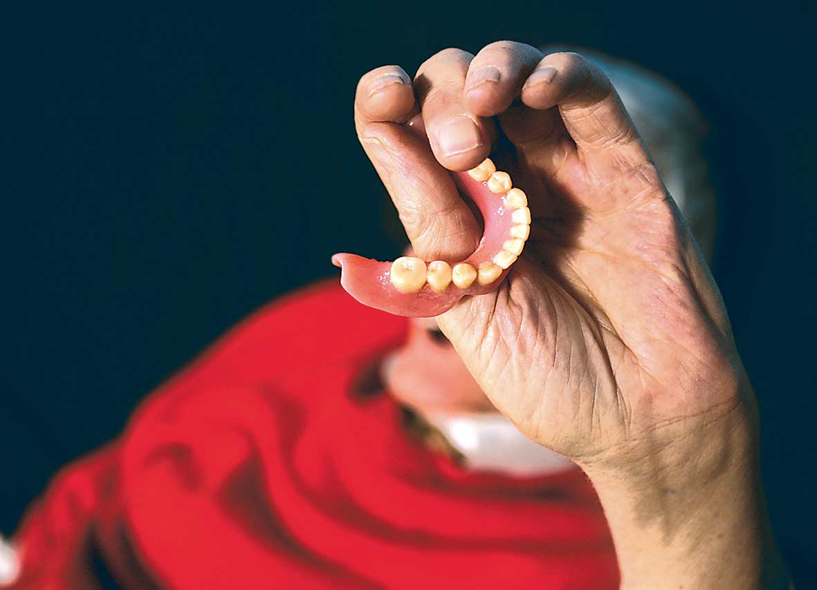 Si-a inghitit proteza in timp ce era la masa!