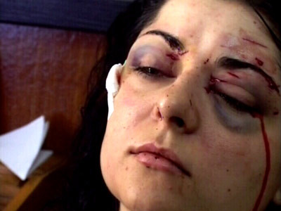 I-a scos ochiul sotiei pentru ca aceasta voia sa divorteze!