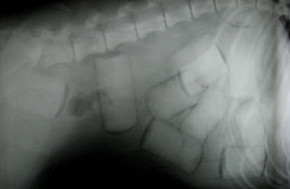 Roman prins pe aeroportul din Istanbul cu 1 kg de cocaina in stomac!