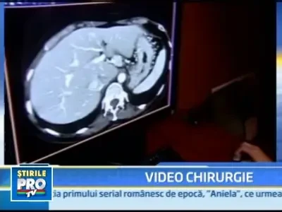 Intr-un spital din Hudson chirurgii folosesc tehnologia jocurilor video