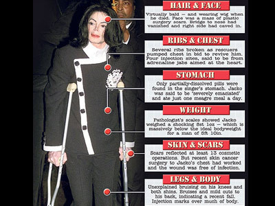 Michael Jackson: Detalii SOCANTE ale autopsiei starului!!!