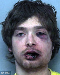 Asa arata, dupa ce a vrut sa jefuiasca un batran de 72 de ani, fost boxer!