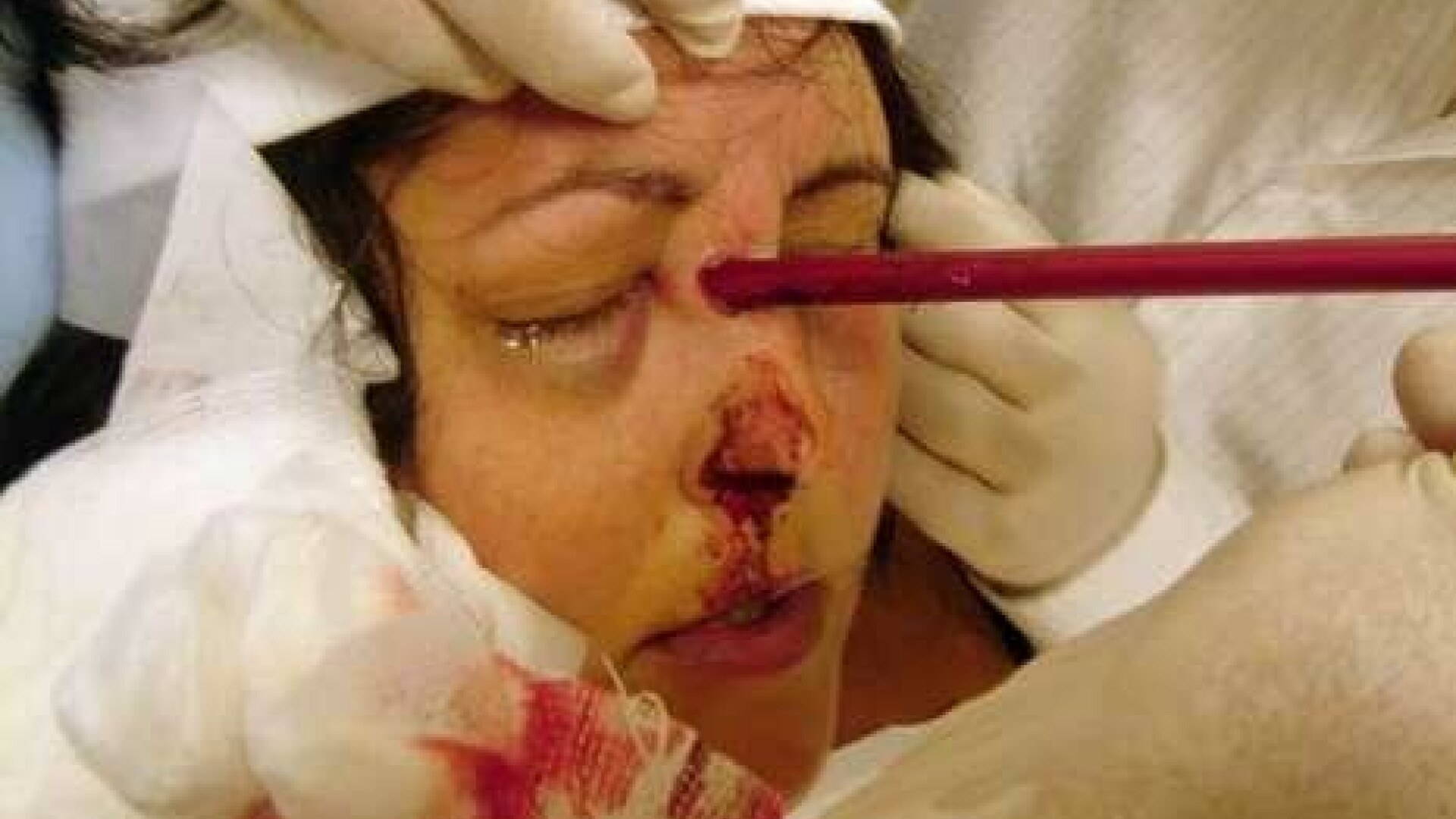 S-a trezit cu o sageata infipta intre ochi!