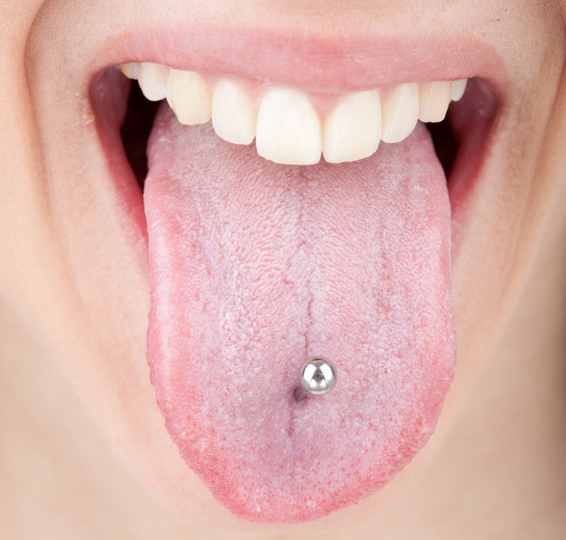 Piercingul bucal, adevarat focar de infectii