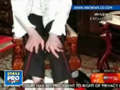 Picioarele lui Michael Jackson, distruse de vitiligo si perfuzii! VEZI FOTO