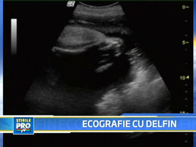 Uite cum arata ecografia unui pui de delfin