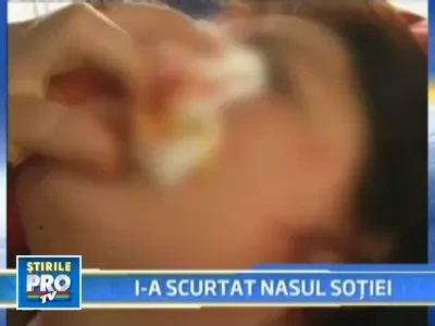 Razbunare dusa la extrem! I-a taiat nasul fostei sotii, din gelozie!