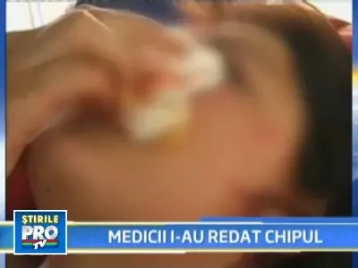 Fostul sot i-a taiat nasul, medicii i l-au pus la loc!