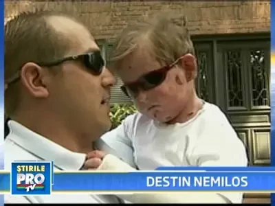 Ii sangereaza pielea la cea mai mica atingere din cauza unei bolii rare!