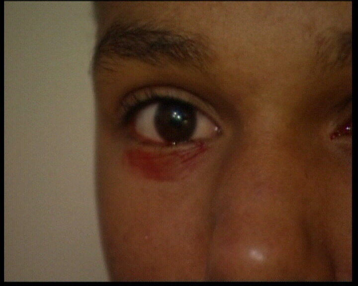 O femeie din India plange cu lacrimi de sange! FOTO