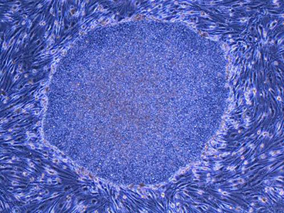 Registrul Donatorilor de Celule Stem, functional la 2 ani de la infiintare