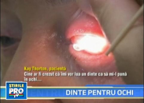 I-au scos un dinte si i-au mutat falca pentru a-i salva ochiul bolnav!