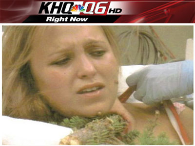 O brad frumos si... dureros! S-a trezit cu o craca infipta in gat!