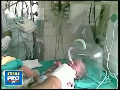 Caz socant in India! Un bebelus s-a nascut cu inima in afara pieptului