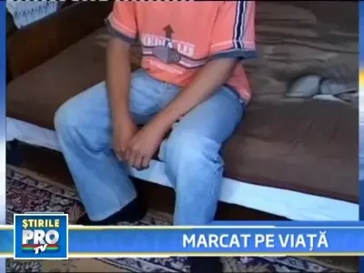 Un adolescent de 15 ani i-a dat foc unui baiat, fara niciun motiv!
