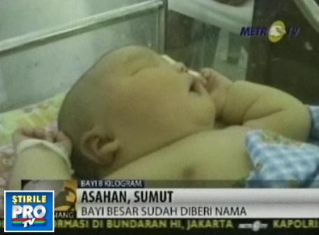 Record in Indonezia! O femeie a nascut un bebelus gigant de 8,7 kg!