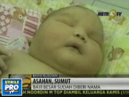 Record in Indonezia! O femeie a nascut un bebelus gigant, de 8,7 kg!
