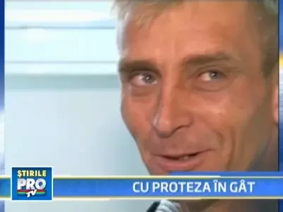 Si-a inghitit proteza in timp ce manca!