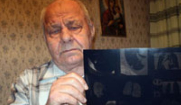 Povestea omului care a trait 68 de ani cu un glont in plaman!