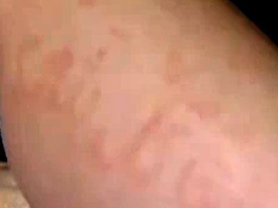 Miracol sau nu? Citate din Coran apar si dispar pe corpul unui copil! VIDEO