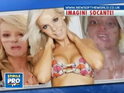 Violata si desfigurata cu acid sulfuric! Vezi galeria foto!