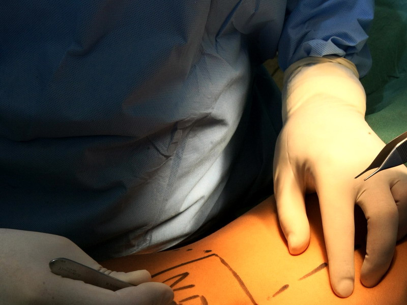 Si frumoase, dar mai ales SANATOASE! Avantajul chirurgiei estetice