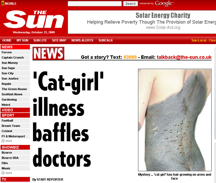 Sufera de o boala teribila, care o transforma in FATA-PISICA!