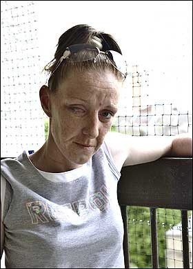 I-a smuls ochiul din orbita, drept pedeapsa pentru ca l-a parasit!