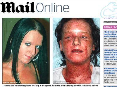 Desfigurata si partial orbita de... vopseaua de par!