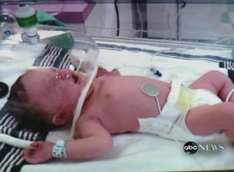 Risca sa moara daca scanceste, din cauza unei paralizii a corzilor vocale