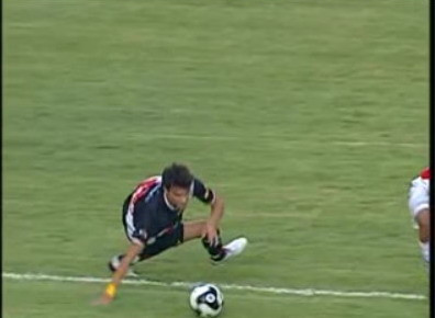 Si-a rupt mana in timpul meciului de fotbal! IMAGINI HORROR