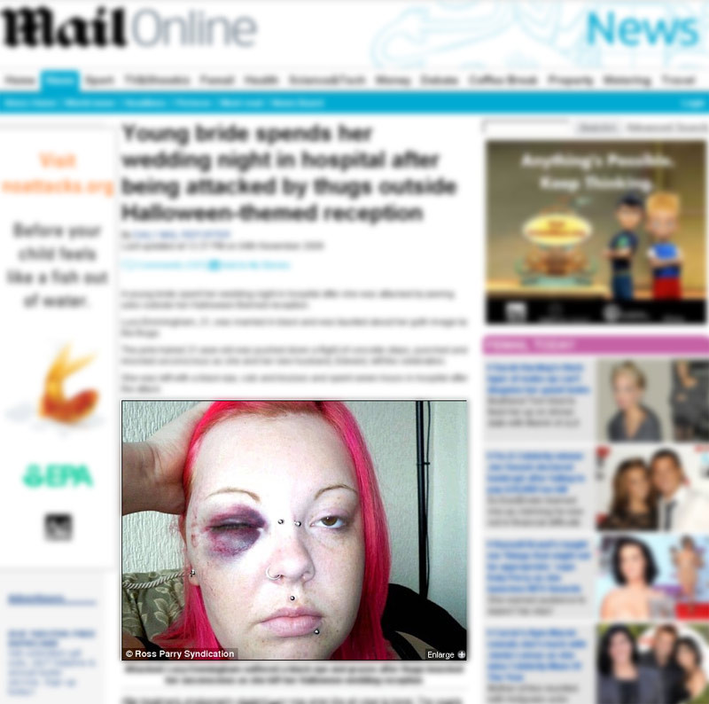 Desfigurata de golani chiar in noaptea nuntii ei!