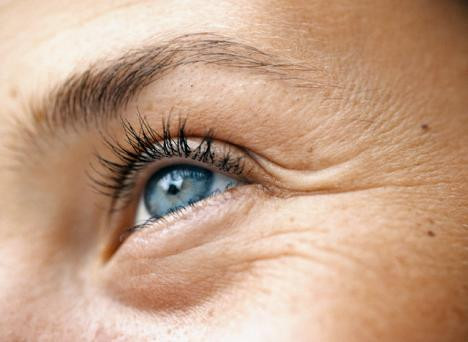 Afla ce trebuie sa faci ca sa scapi de inesteticele cearcane