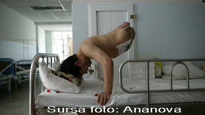 Chinezul amputat pe jumatate inca uimeste lumea medicala!