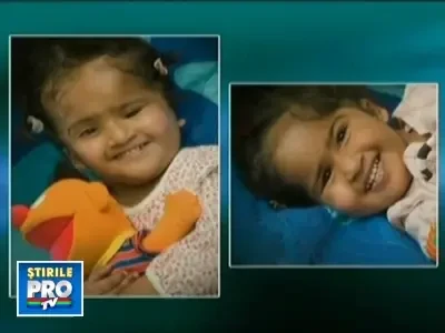 Siamezele din Bangladesh, unite in zona capului, au fost separate cu succes