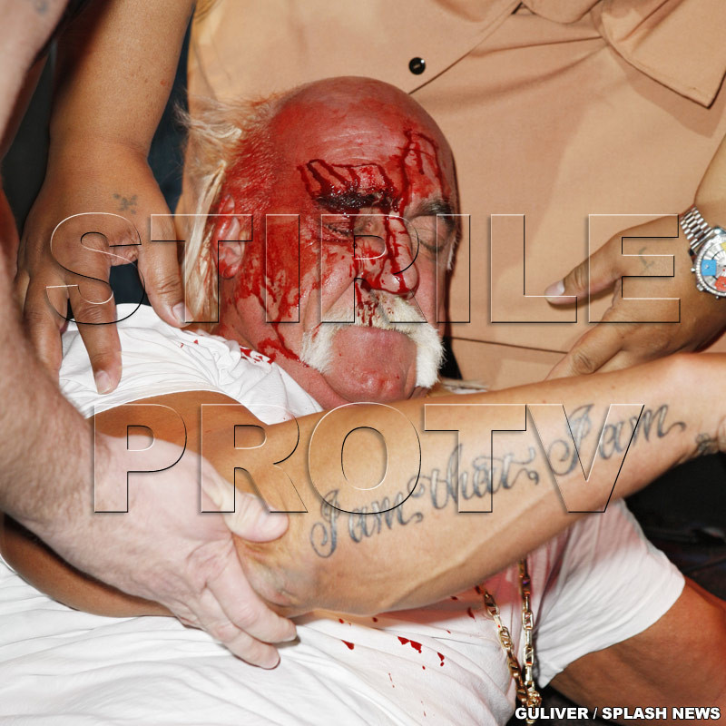 Hulk Hogan, plin de sange si doborat la pamant de rivalul de-o viata!