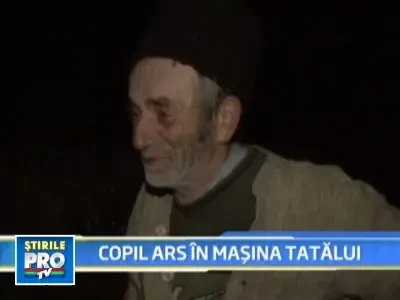 Medicii fac eforturi sa-l salveze pe baietelul ars in masina tatalui sau!
