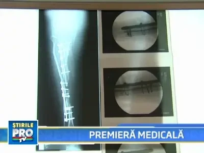 Premiera! Medicii au reconstruit o tibie, din alte oase si celule stem