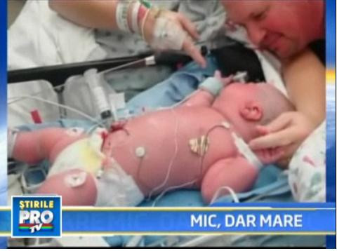 Uite-l pe Axel, bebelusul de 7 kilograme nascut... prematur!