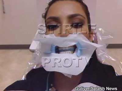 Cam dusa! Kim Kardashian te miroase si iti spune daca ai carii!