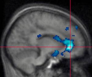 Violenta afecteaza structura creierului la adolescenti!