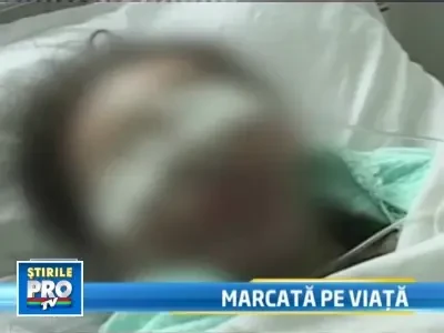 Razbunare crunta la Radauti! I-a aruncat cu acid sulfuric in fata!