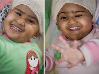 Siamezele separate in Australia vor petrece sarbatorile acasa