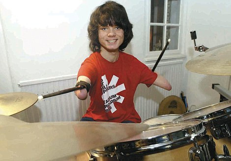 Orfan din Romania, nascut fara brate, admis la Universitatea Oxford!