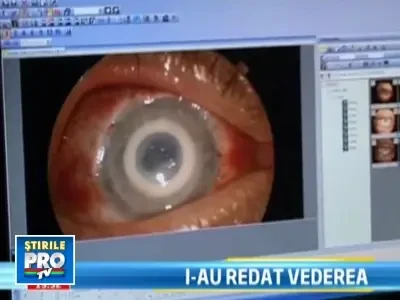 S-a realizat primul transplant de cornee artificiala in Romania!