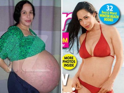 Cele mai recente operatii estetice nereusite ale vedetelor