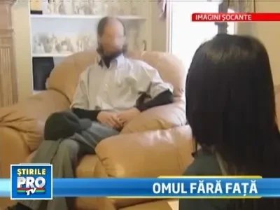 SOCANT! I s-a topit chipul dupa ce s-a electrocutat!