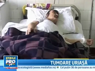 Cantareste 30 de kg dupa ce medicii i-au extirpat o tumoare de 17 kg!