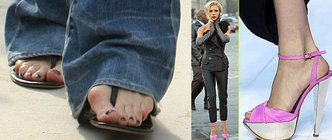 Victoria Beckham, deformata din cauza pantofilor cu toc!